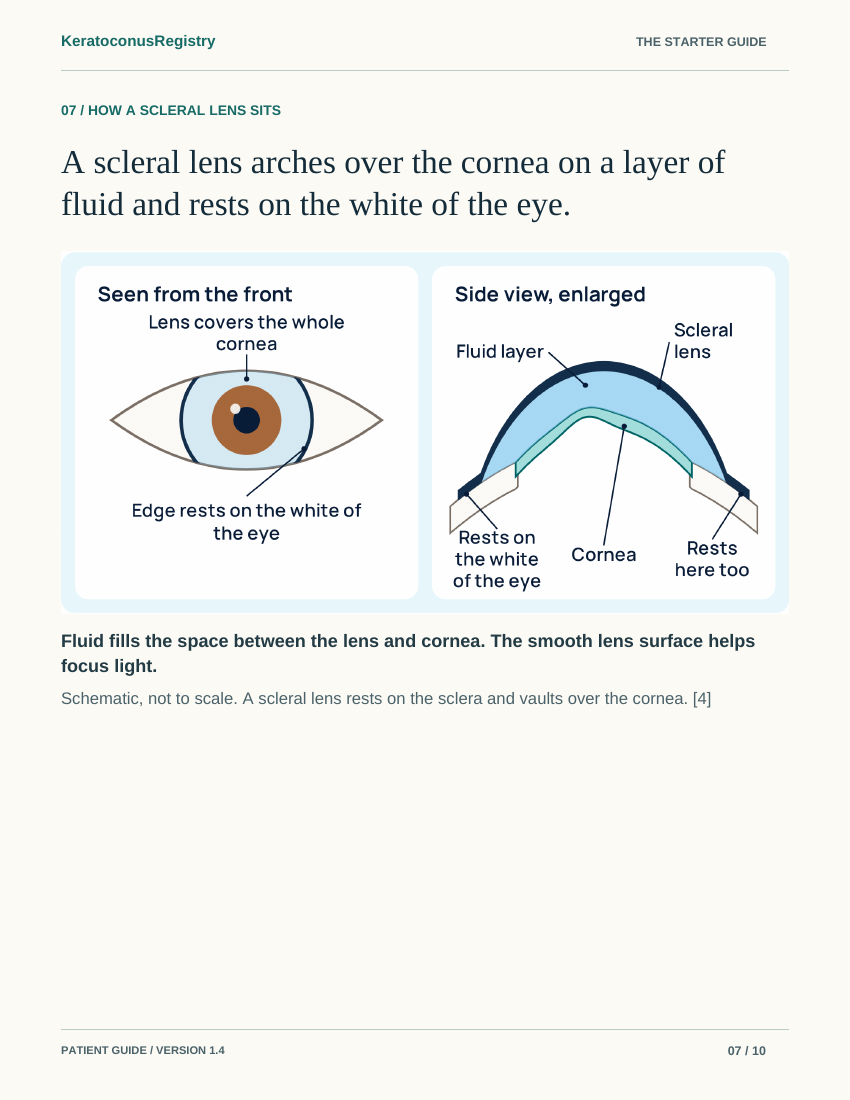 Page 7 of the guide: a full-page labeled drawing of a scleral lens, seen from the front and in an enlarged side view.